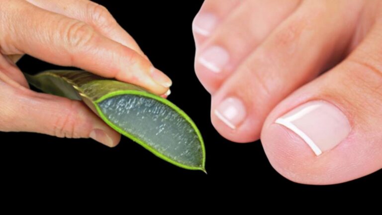 Un vecchio trucco per eliminare la micosi delle unghie con ingredienti semplici…