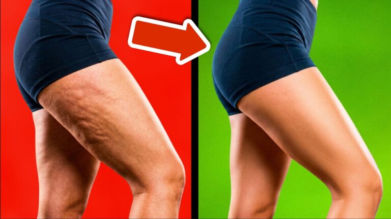 Scopri 5 metodi rapidi per eliminare cellulite e smagliature!