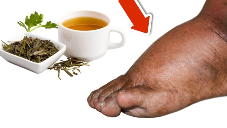 7 tisane per eliminare gonfiori a gambe e piedi in modo naturale! Scopri come!