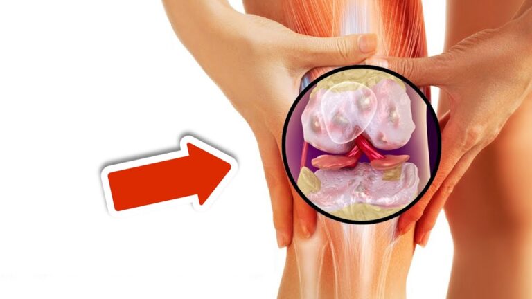 3 vitamine incredibili per riparare le tue articolazioni doloranti