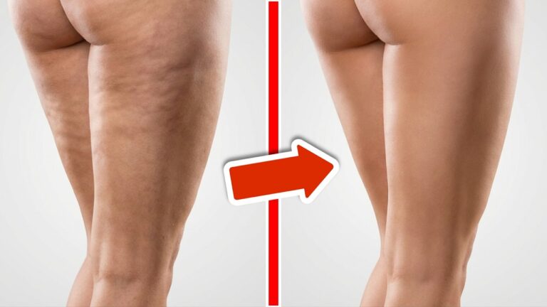 Scopri 5 strategie rapide per combattere la cellulite e sentirti fantastica!